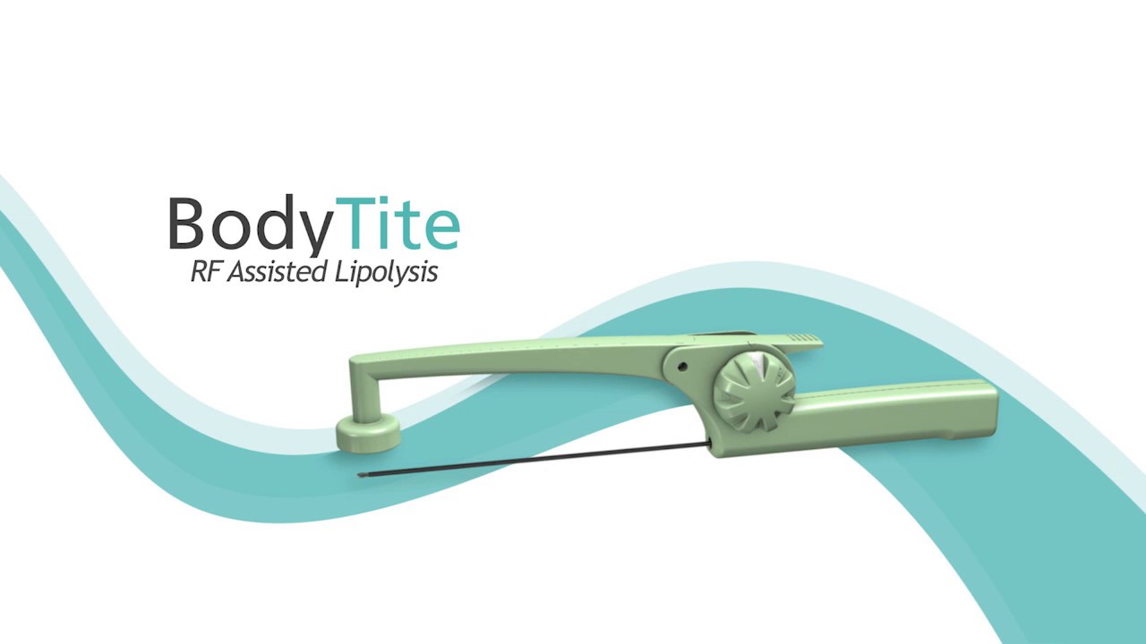 Aufpreis Bodytide in Vollnarkose